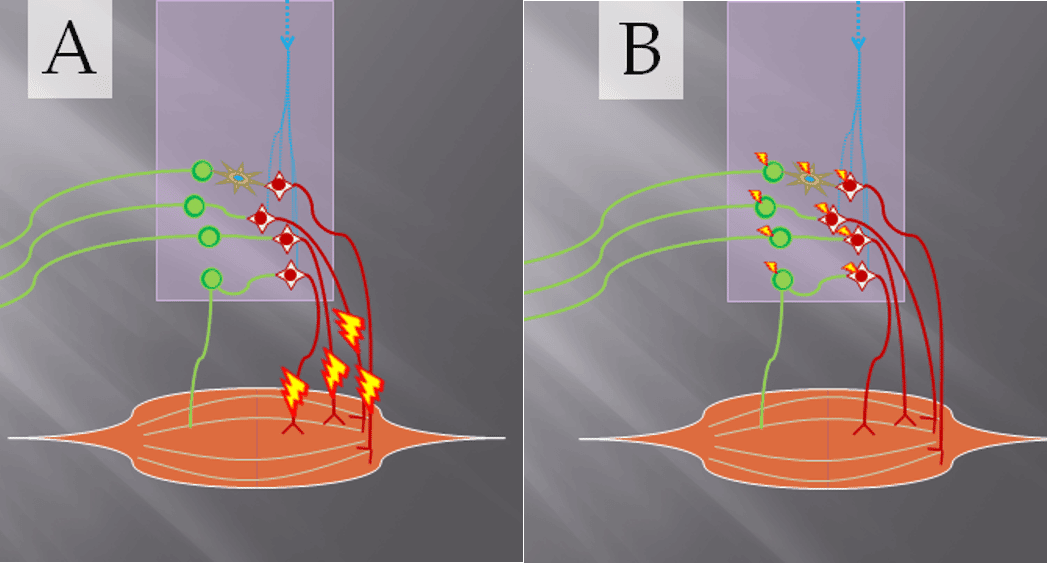 Comparison of FES and spinal cord stimulation