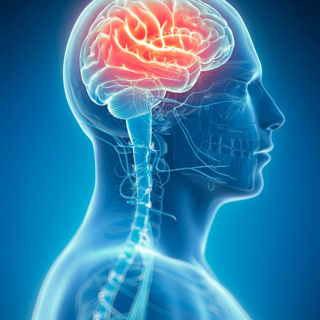 A graphic demonstrating a traumatic brain injury.