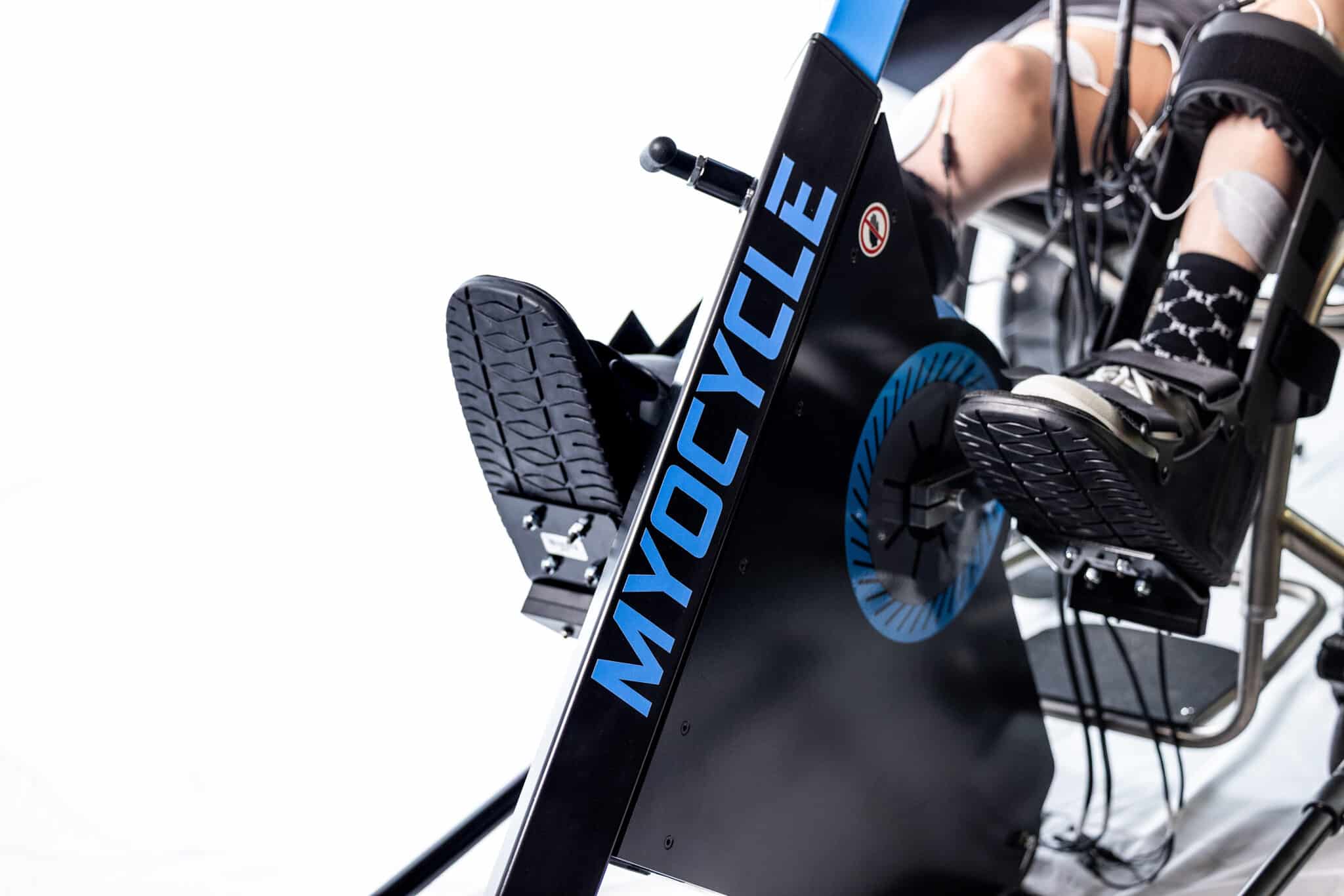 Spasticity in Legs: What is it, What Causes it, and How to Reduce it?