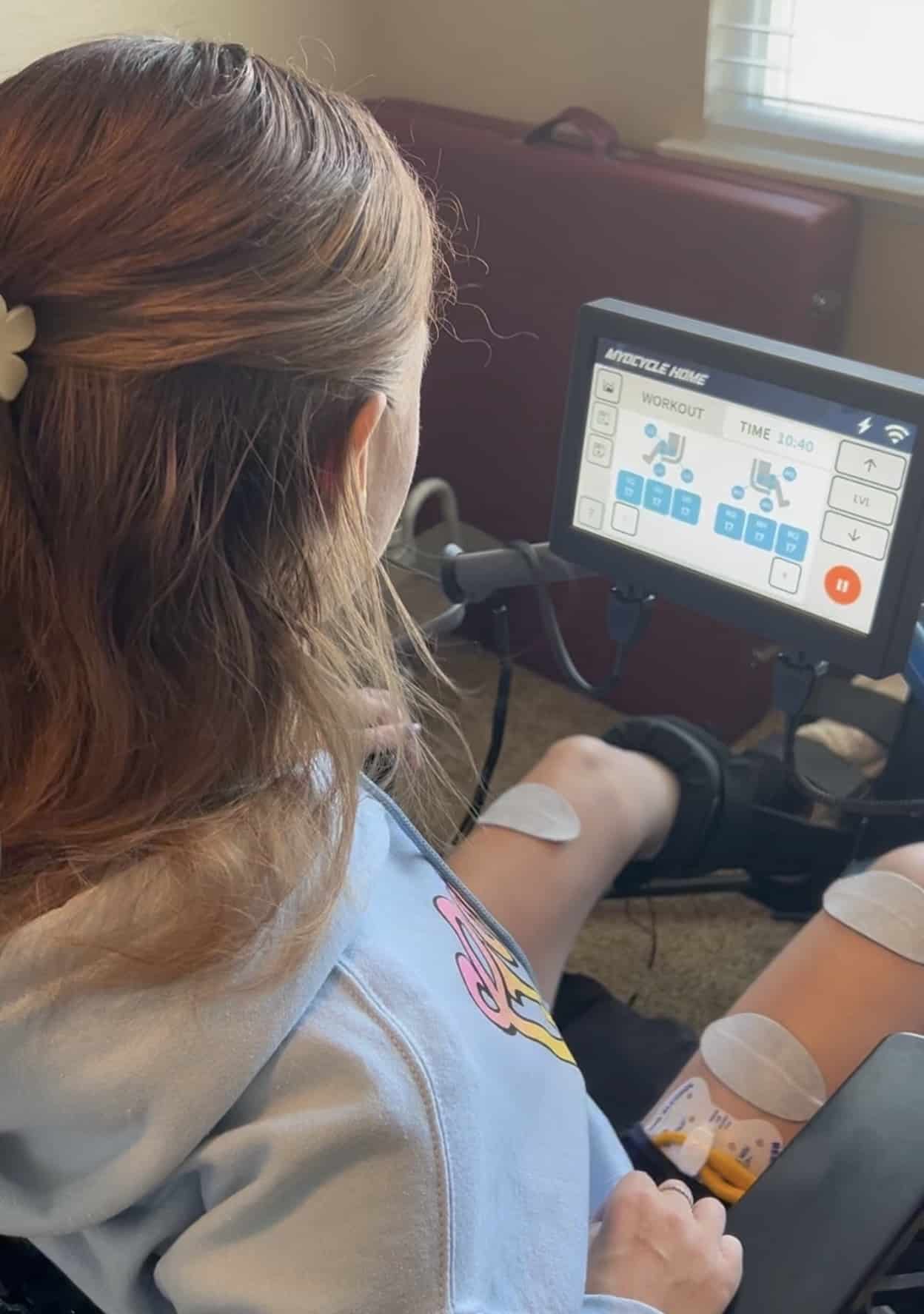 Functional electrical stimulation and spinal cord stimulation