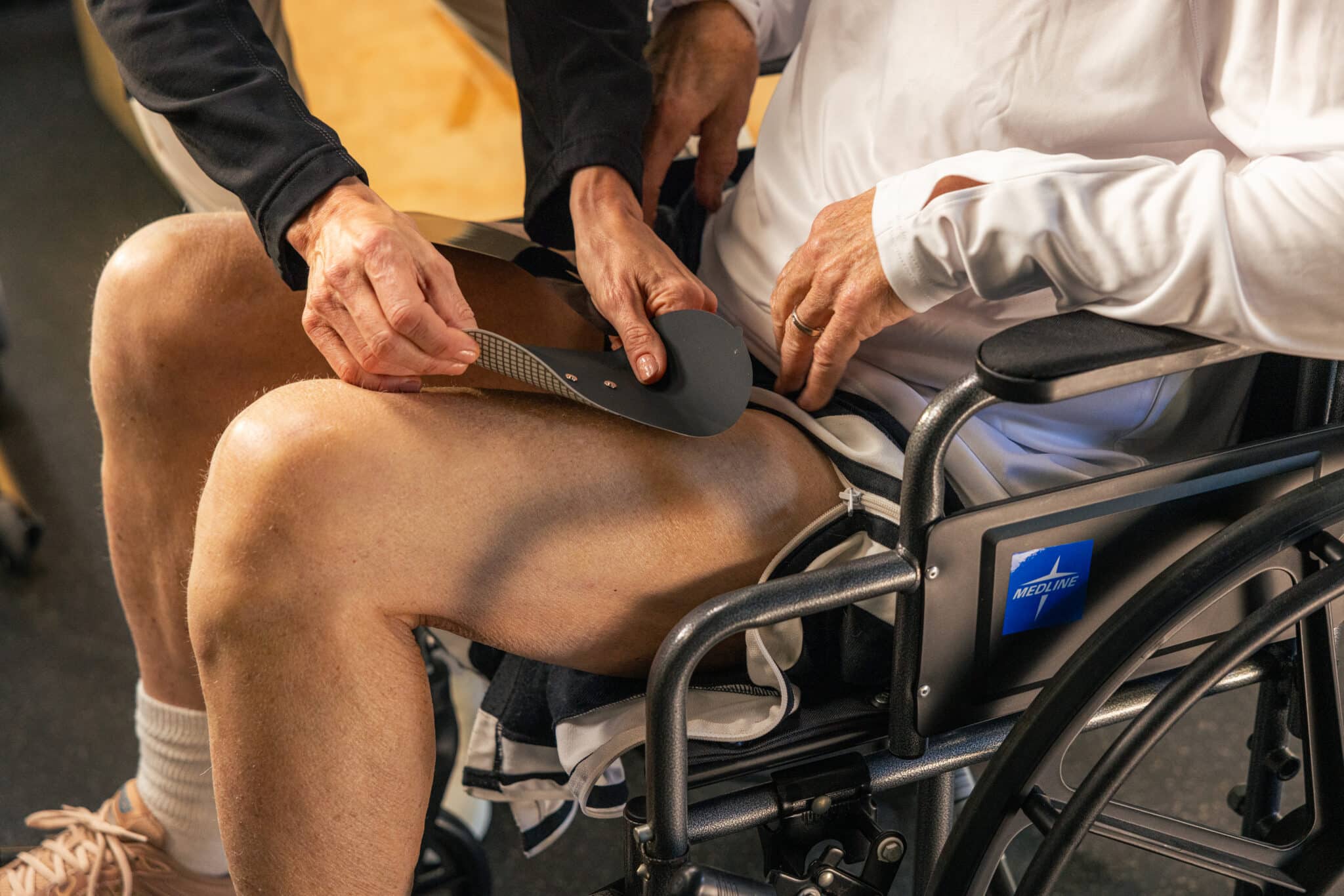 A person in a wheelchair receives assistance as another helps fit a MyoSpark NR prosthetic limb to their thigh. The focus is on their hands and the device, highlighting the process of adjustment and support.