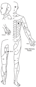 Diagram showing the key sensory points used in the ASIA (AIS) assessment for spinal cord injuries, labeled by spinal nerve levels C2–C8, T1–T12, L1–L5, and S1–S5 on the body, hands, and feet.